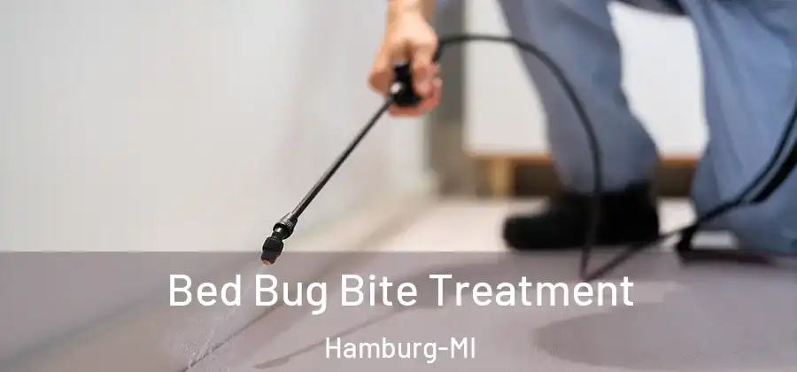  Bed Bug Bite Treatment Hamburg-MI